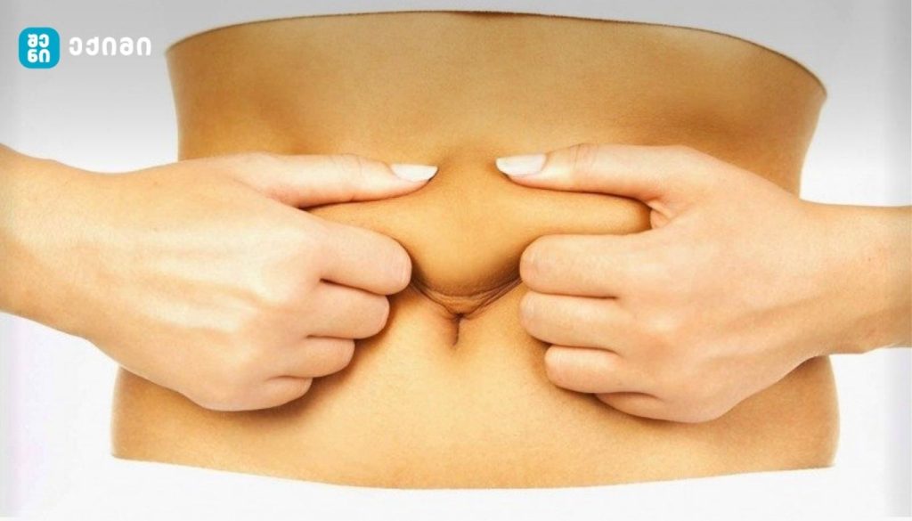 როგორ მოვიშოროთ მუცლის ცხიმი