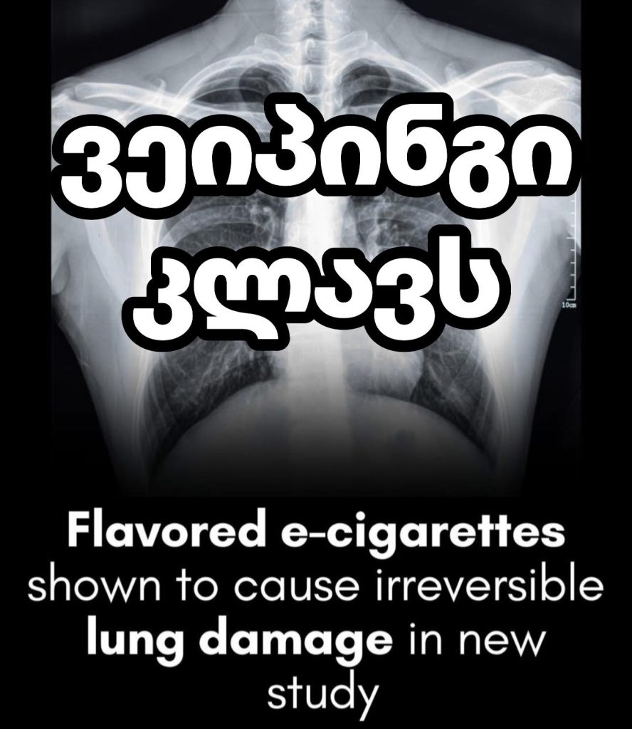 ვეიპინგი კლავს – მოზარდი „პოპკორნის ფილტვით“ მძიმე დაავადებას ებრძვის, ტოქსიკურია და სიცოცხლისთვის საშიში | sheniekimi.ge | შენი ექიმი