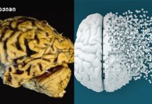 მეცნიერების ახალი აღმოჩენა ალცჰაიმერთან ბრძოლაში დემენციისა და ალცჰაიმერის პრევენციაზე ზრუნვა პირველი ნიშნების გამოვლენამდე უნდა დაიწყოს