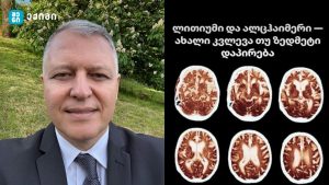 ლითიუმი და ალცჰაიმერი — ახალი კვლევა თუ ზედმეტი დაპირება?