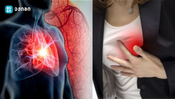 ამ მინიშნებებს ყურადღება უნდა მიაქციოთ, რადგან გულის შეტევის წინაპირობად ითვლება