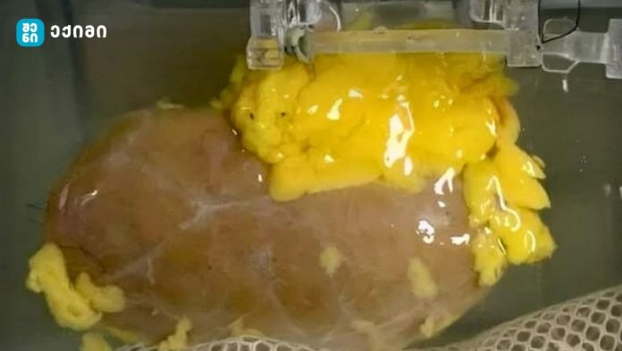 universaluri tirkmeli sisxlis kvela jgufistvis მეცნიერებმა შექმნეს უნივერსალური თირკმელი, რომელიც სისხლის ყველა ჯგუფთან თავსებადია