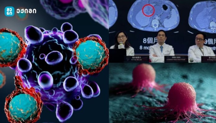 მეცნიერებმა დაუნის სინდრომის მკურნალობისკენ უზარმაზარი ნაბიჯი გადადგეს - CRISPR მეთოდით მოაშორეს დაუნის სინდრომის ქრომოსომა ქრომოსომა