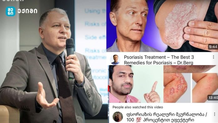 სკანდალი გრძელდება: “არუნა ხათრი” პირდაპირ ბაძავს ექიმ ბერგს — იმეორებს მის სტილს, ფრაზებს და მიდგომას. ეს უკვე აღარ არის „ინსპირაცია“ — ეს არის პლაგიატი და საზოგადოების შეგნებული მოტყუება“-გიორგი ფხაკაძე 