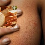 “გლუტეინი” – გაეცანით 8 მიზეზს, იქნებ თქვენც გაქვთ გლუტეინის აუტანლობა “გლუტეინი” – გაეცანით 8 მიზეზს, იქნებ თქვენც გაქვთ გლუტეინის აუტანლობა