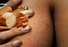 “გლუტეინი” – გაეცანით 8 მიზეზს, იქნებ თქვენც გაქვთ გლუტეინის აუტანლობა “გლუტეინი” – გაეცანით 8 მიზეზს, იქნებ თქვენც გაქვთ გლუტეინის აუტანლობა