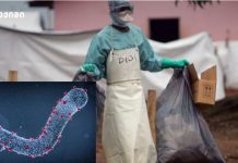 „იწვევს სისხლდენას, მაღალ სიცხესა და დიარეას“ – რა ვიცით „მარბურგის ვირუსის“ შესახებ, რომელიც ეთიოპიაში გავრცელდა „იწვევს სისხლდენას, მაღალ სიცხესა და დიარეას“ - რა ვიცით „მარბურგის ვირუსის“ შესახებ, რომელიც ეთიოპიაში გავრცელდა