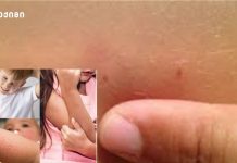 „ქსოვილებზე, რბილ სათამაშოებზე შეიძლება, დიდხანს გაჩერდეს – კანით კანთან მჭიდრო კონტაქტით გადადის…“