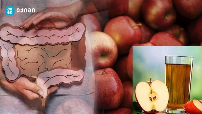 აქედან მხოლოდ 1 ჭიქას შეუძლია ნაწლავის მოძრაობა სულ რაღაც 30 წუთში! Სცადე! შედეგი გარანტირებულია!