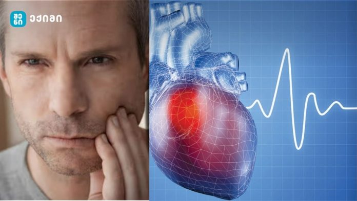 რა არის ინფარქტის ერთ-ერთი ყველაზე გავრცელებული ნიშანი - „ქვედა ყბის და კბილების ტკივილი მიოკარდიუმის ინფარქტის ერთ-ერთი ნიშანია...“