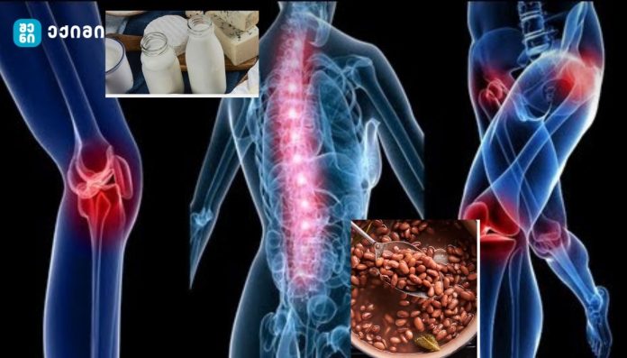 ძვლების დამცველი – გაქვს ოსტეოპოროზი? შეაჩერე ახლავე!