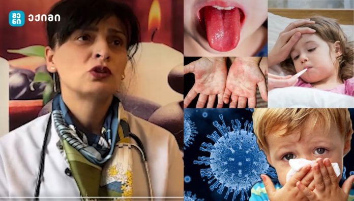 ექიმის საგანგებო მიმართვა და გაფრთხილება მშობლებს - 