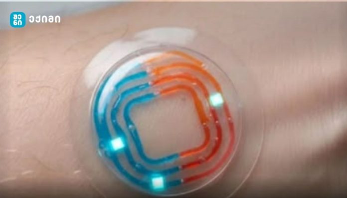 ოფლის პაჩი ნემსის გარეშე — დიაბეტის მართვის მომავალი თუ გადაჭარბებული მოლოდინი?