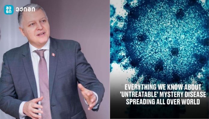 ukurnebeli daavadeba-adenovirusi „უკურნალებელი საიდუმლო დაავადება“ — რატომ არის ეს სათაური შეცდომაში შემყვანი და რას უნდა ვიცოდეთ ადენოვირუსის შესახებ