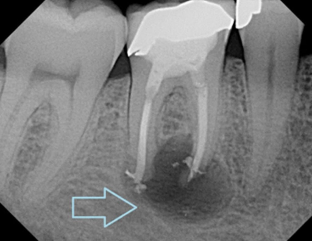 რატომ არის პირის ღრუს ჯანმრთელობა ორგანიზმისთვის კრიტიკულად მნიშვნელოვანი? | sheniekimi.ge | შენი ექიმი