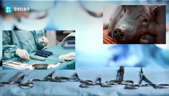 ეს ტექნოლოგია არა მხოლოდ ინდივიდუალური პაციენტების სიცოცხლეს ეხება, არამედ მთელ ჯანდაცვის სისტემას - ადამიანებს გენმოდიფიცირებული ღორის თირკმელებს გადაუნერგავენ: კლინიკური კვლევები დამტკიცდა