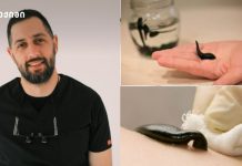 სისხლძარღვთა ქირურგი მოსახლეობას აფრთხილებს – „წურბელის ნერწყვში არის ბაქტერია, რომელმაც შეიძლება გამოიწვიოს მძიმე ინფექციები“