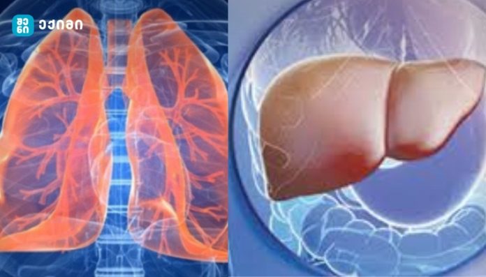 ისინი ერთმანეთზე გადაჯაჭვული „პარტნიორები“ არიან! - ფილტვები და ღვიძლი: ორგანიზმის ორი „გიგანტის“ საიდუმლო ალიანსი