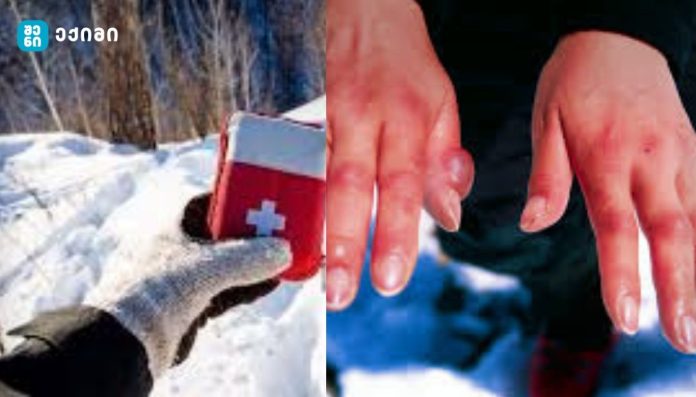 როდის ვითარდება ჰიპოთერმია, ანუ სხეულის გადაცივება - როგორ გავუწიოთ პირველადი დახმარება ჰიპოთერმიის დროს?