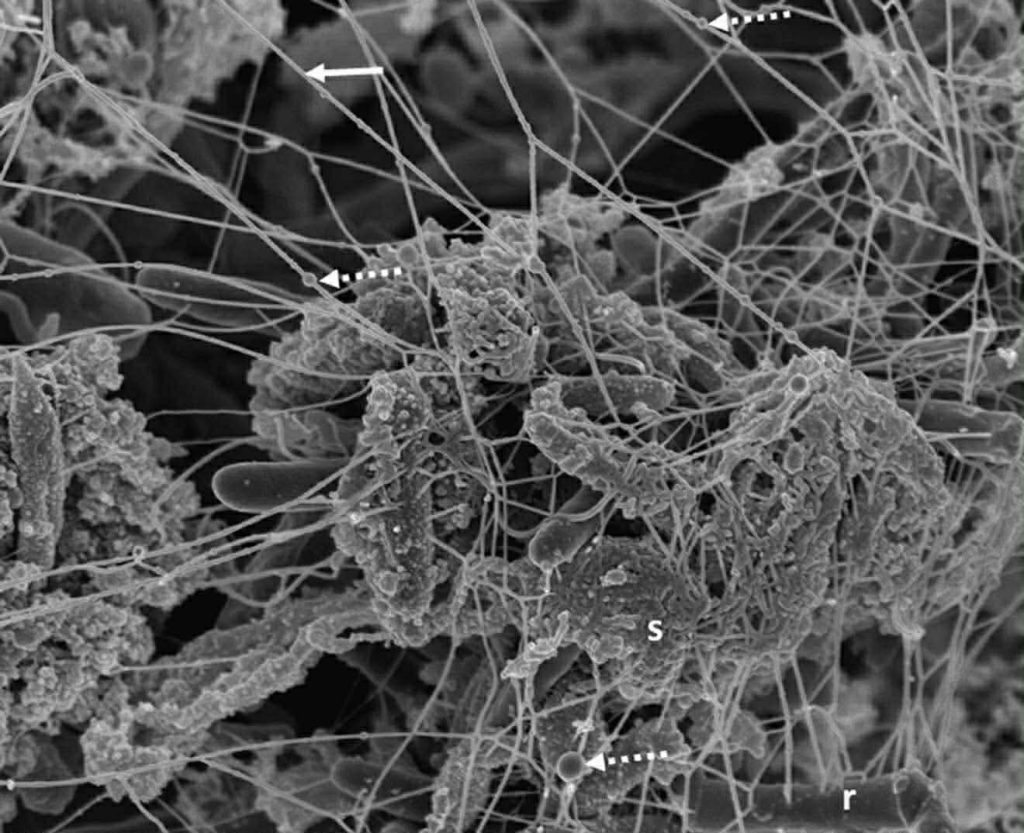 რატომ ვერ იწმინდება ნადების 80 % სახლში? | sheniekimi.ge | შენი ექიმი