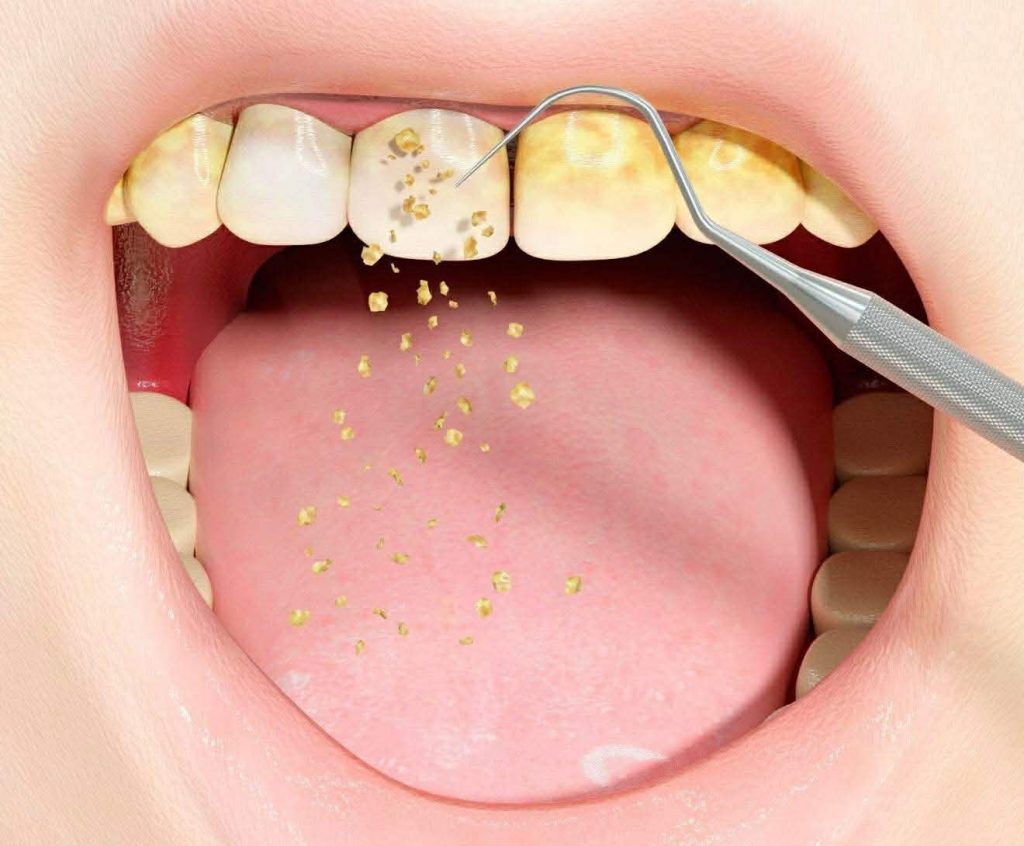 რატომ ვერ იწმინდება ნადების 80 % სახლში? | sheniekimi.ge | შენი ექიმი