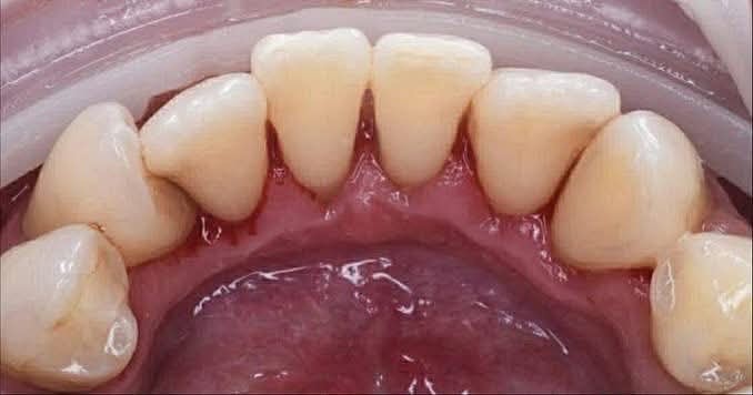 რატომ ვერ იწმინდება ნადების 80 % სახლში? | sheniekimi.ge | შენი ექიმი