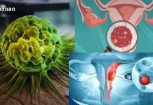 ვეტერინარული პრეპარატი კიბოს „მკურნალად“ — საშიში მითი, რომელიც სიცოცხლეს საფრთხეს უქმნის კვლევა — ვეტერინარული პრეპარატი, რომელიც გამოიყენება ცხოველებში პარაზიტული ინფექციების სამკურნალოდ — თაგვების მოდელში საშვილოსნოს ყელის კიბოს სრული ჩახშობისა და 100%-იანი გადარჩენის შედეგს უკავშირდება