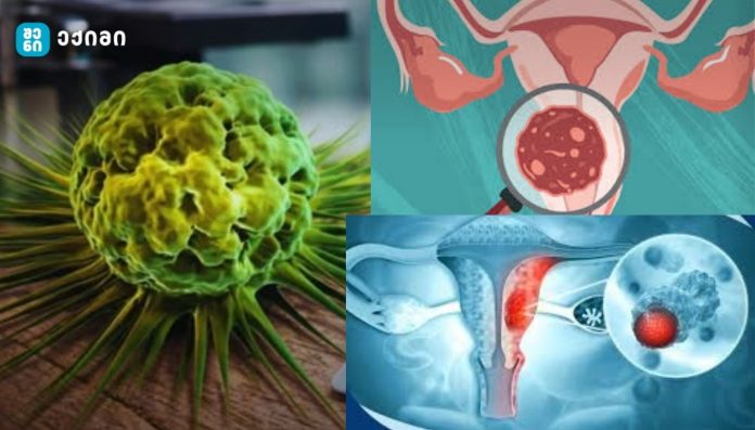 კვლევა — ვეტერინარული პრეპარატი, რომელიც გამოიყენება ცხოველებში პარაზიტული ინფექციების სამკურნალოდ — თაგვების მოდელში საშვილოსნოს ყელის კიბოს სრული ჩახშობისა და 100%-იანი გადარჩენის შედეგს უკავშირდება