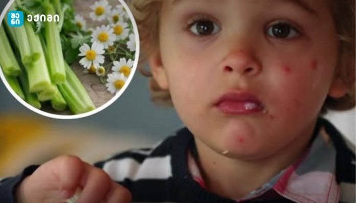 lutoolinis shemcveli danamati da autizmi ლუტეოლინის შემცველი დანამატი და აუტიზმის სპექტრის აშლილობა: საპილოტე კვლევის შედეგების კრიტიკული ანალიზი