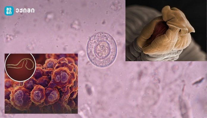 მეცნიერებმა დაადასტურეს კიბოს უნიკალური ფორმა — სიმსივნე, რომელიც პარაზიტის უჯრედებიდან წარმოიშვა