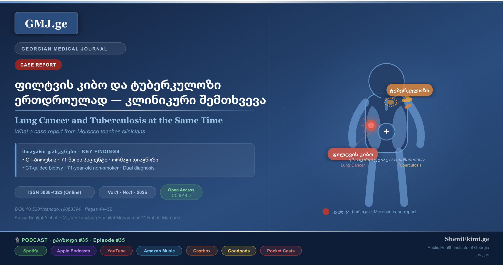 ფილტვის კიბო და ტუბერკულოზი ფილტვის კიბო და ტუბერკულოზი