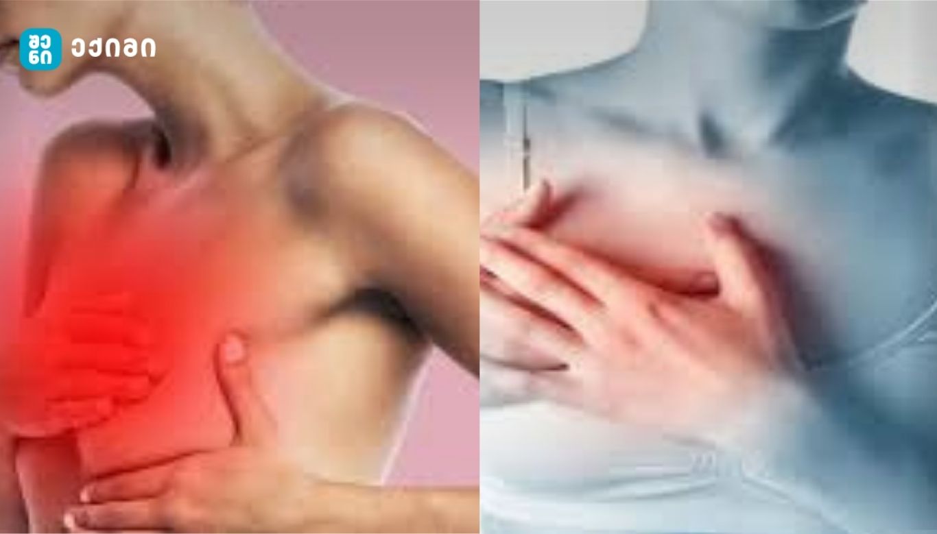 aris tu ara sashishi mkerdis tkivili არის თუ არა საშიში მკერდის ტკივილი და რა შემთხვევაში უნდა გაკეთდეს ბიოფსია?