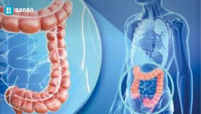 Illustration of the human digestive system with the colon highlighted in orange