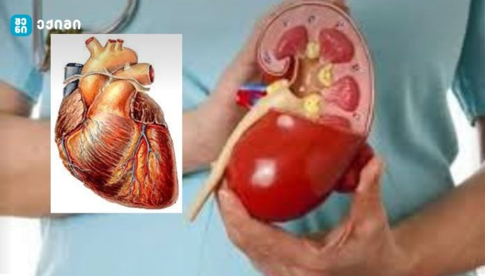 გული და თირკმელი ადამიანის ორგანიზმში ცალ-ცალკე მოქმედი ორგანოები არ არის - სისხლის მიმოქცევის „დუეტი“: რატომ არის გული და თირკმელი განუყოფელი