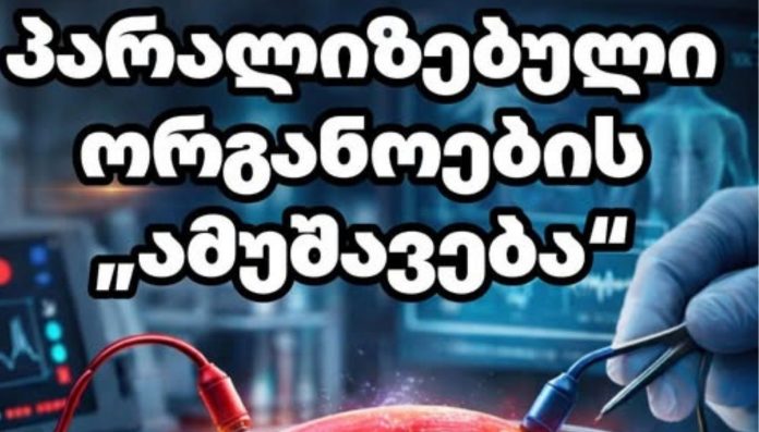 paralizebuli organoebis amushaveba პარალიზებული ორგანოების „ამუშავება“ — მეცნიერება რეალურად ცვლის თამაშის წესებს?