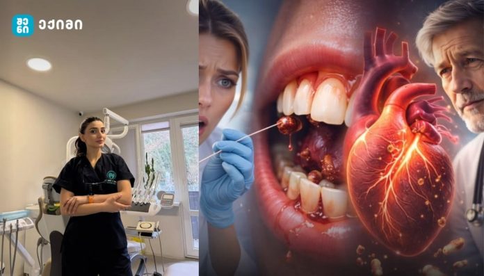 პატარა კარიესიდან სიცოცხლისთვის საშიშ გულის ინფექციამდე — ფარული საფრთხე, რომელსაც ბევრი ადამიანი სათანადოდ არ აფასებს ეს გაზვიადება არ არის