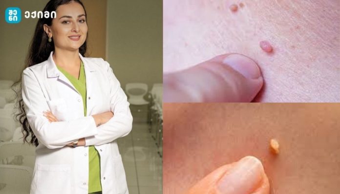 Female doctor in a white coat standing confidently in a clinic; collage includes close‑ups of skin lesions on the skin sample panel.