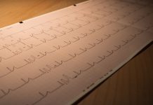 გულის ვიზუალიზაციის AI-ანალიზმა პაციენტში გადანერგვის აუცილებლობა ადრეულ ეტაპზე გამოავლინა AI-გაძლიერებული გულის ვიზუალიზაცია