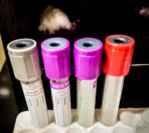 ახალი მეტაანალიზის მიხედვით, მაგნიუმის დანამატებმა შესაძლოა არტერიული წნევა 6 მმ ვწყ. სვ.-ით შეამციროს