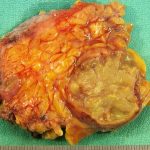 მთავარი | sheniekimi.ge | Page 957 | შენი ექიმი