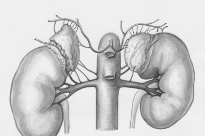 Anatomical illustration of both kidneys connected to the aorta with renal arteries branching to each kidney.