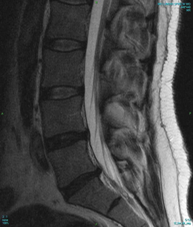 ზურგის ტკივილი — სამედიცინო გამოსახულება