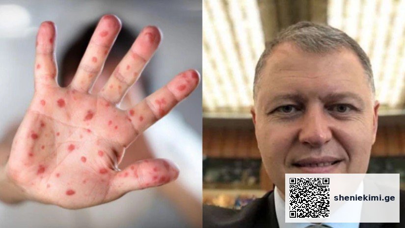 „WHO მხარს უჭერს ქვეყნებს, რომ მოემზადონ შემთხვევების პოტენციური ზრდისთვის“ – გიორგი ფხაკაძე | sheniekimi.ge | შენი ექიმი