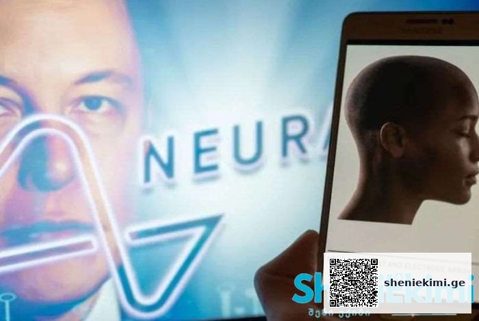 Neuralink-მა ადამიანის ტვინში ჩიპი პირველად ჩანერგა | sheniekimi.ge | შენი ექიმი