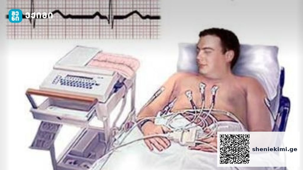 ელექტროკარდიოგრაფია (ECG/EKG) – ყველაფერი, რაც უნდა იცოდეთ, რას წარმოადგენს და როგორ მუშაობს – საინფორმაციო ბუკლეტები | sheniekimi.ge | შენი ექიმი