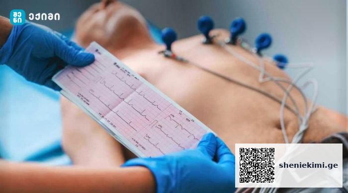 ელექტროკარდიოგრაფია (ECG/EKG) – ყველაფერი, რაც უნდა იცოდეთ, რას წარმოადგენს და როგორ მუშაობს – საინფორმაციო ბუკლეტები | sheniekimi.ge | შენი ექიმი