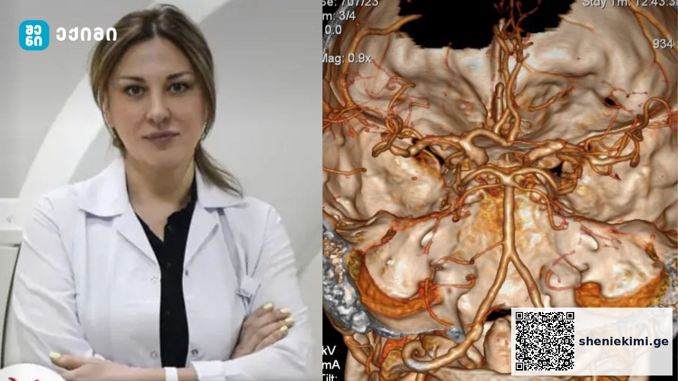რა უნდა ვიცოდეთ კისრის და თავის ტვინის (ბრაქიოცეფალური) სისხლძარღვებზე | sheniekimi.ge | შენი ექიმი