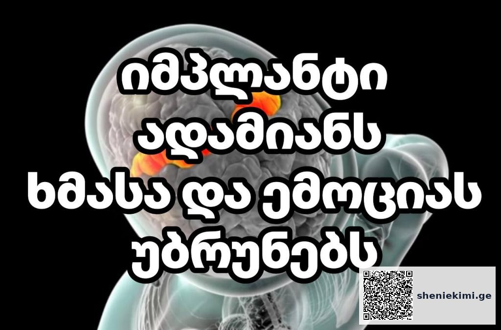 ისტორიული გარღვევა ნეიროტექნოლოგიაში – იმპლანტი, რომელიც ადამიანს ხმასა და ემოციას უბრუნებს | sheniekimi.ge | შენი ექიმი