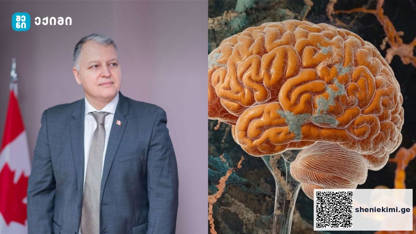 ტვინი გრძნობს ყველაფერს — გარდა ტკივილისა! – ტვინი ტკივილზე ფიქრობს, მაგრამ მას ვერ გრძნობს – კითხვა-პასუხი | sheniekimi.ge | შენი ექიმი