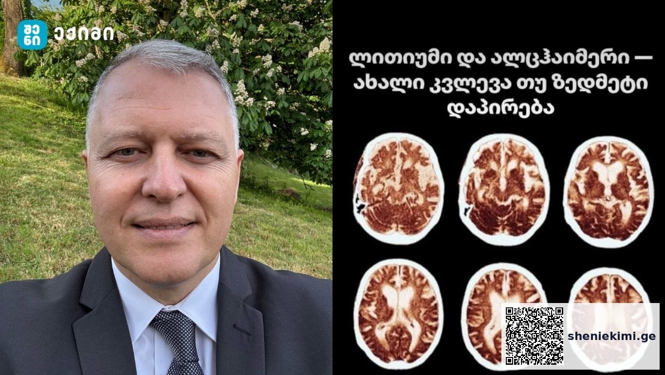ლითიუმი და ალცჰაიმერი — ახალი კვლევა თუ ზედმეტი დაპირება? | sheniekimi.ge | შენი ექიმი